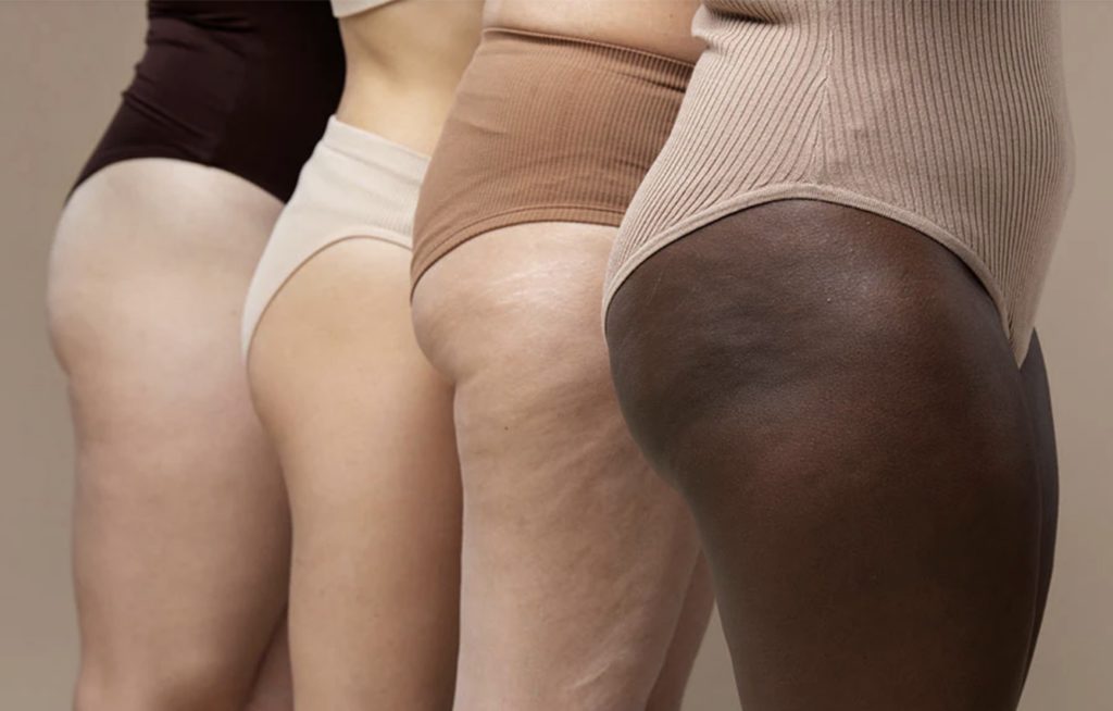 Ménopause et cellulite : pourquoi elle devient plus visible, et comment s'adapter