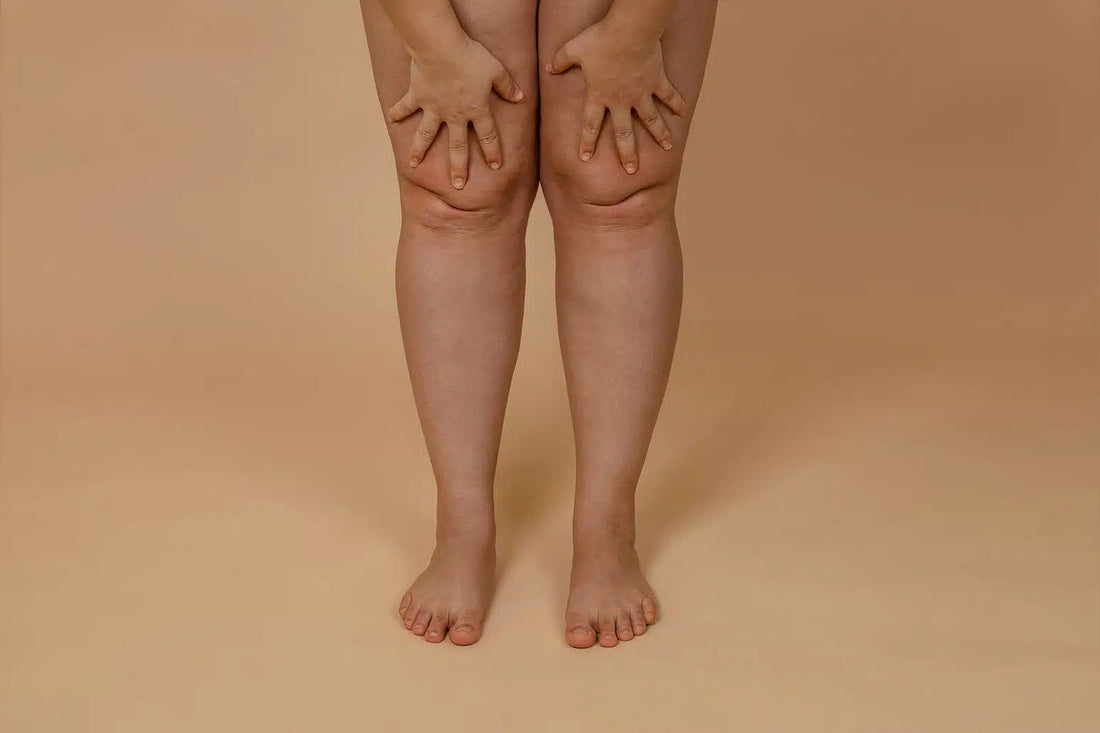 Jambes lourdes : pourquoi, et que faire au quotidien ?
